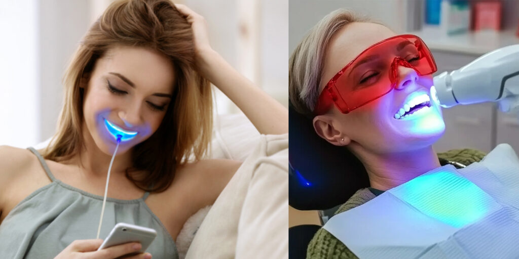 冷光牙齒美白效果與價格